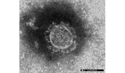 想定外の感染力
～発病前のウイルス排出とマイクロ飛沫～
