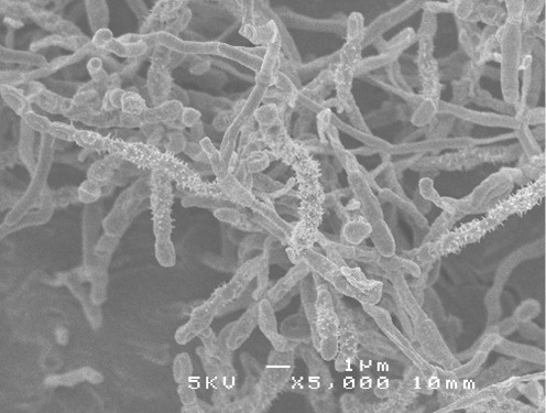 Streptomyces incarnatus