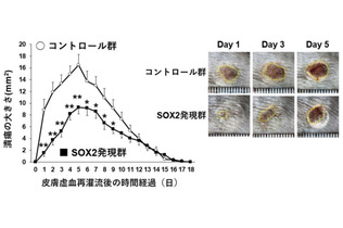 表皮細胞のSOX2が褥瘡の発生を抑制