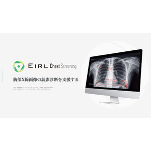 胸部X線画像の読影診断を支援するEIRL Chest Screening、感度優先／特異度優先の選択ができる新モデルを発売