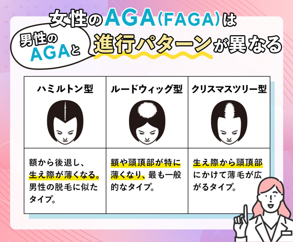 女性のAGA（FAGA）の種類