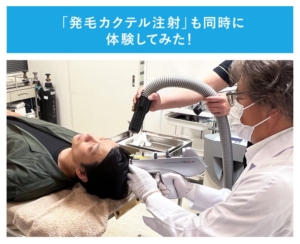 発毛カクテル注射も同時に体験してみた