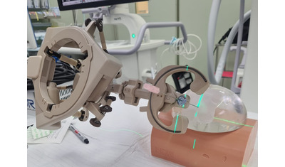 人工知能搭載ロボットによる内視鏡腎結石治療で従来法以上の治療成績を報告－名古屋市立大学