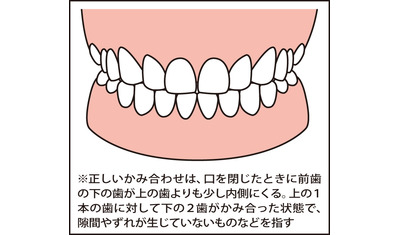 歯並び悪いと中高年以降に影響～矯正で健康を守る（日本臨床矯正歯科医会　野村泰世会長）～