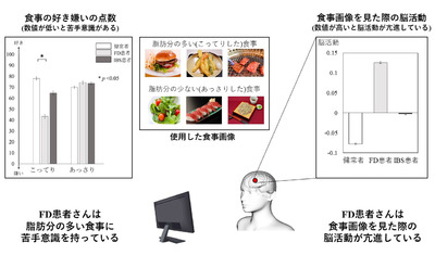 機能性ディスペプシア患者は食事画像を見るだけで脳に負担がかかることが明らかに―世界初