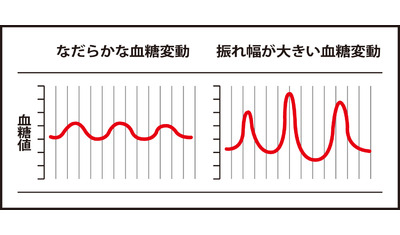 血糖の変動を可視化～持続血糖モニター機器（東京慈恵会医科大学付属病院　西村理明主任教授）～