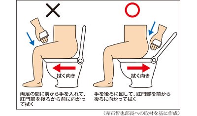 排便後のお尻の拭き方～尿路感染症を予防（宮城中央病院　赤石哲也部長）～