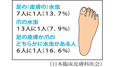 ７人に１人は水虫～治療しないと爪まで広がる恐れ（神奈川はた皮膚科クリニック　畑康樹院長）～