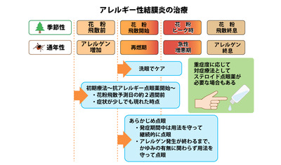 目のかゆみ、「１日１回」まぶたに塗るだけ～アレルギー性結膜炎にクリーム～