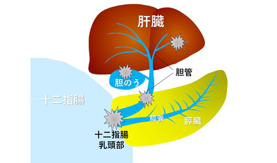 がん治療で後悔しない選択～医師と患者の対話が鍵～