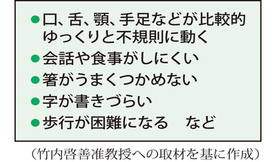 口や舌が勝手に動く～遅発性ジスキネジア（慶応大学病院　竹内啓善准教授）～