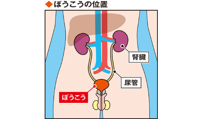 排尿トラブルに潜む場合も～ぼうこうがん（弘前大医学部付属病院　畠山真吾教授）～
