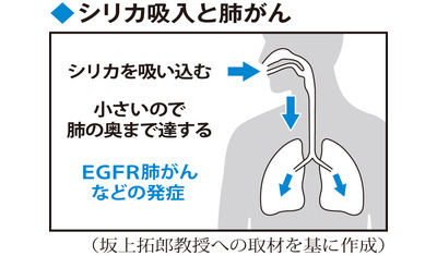 治療法開発進む―肺がん～発症メカニズム解明も（熊本大病院　坂上拓郎教授ら）～