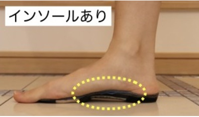 第9回 靴底の減り方で分かる足の問題点
～５パターンのうち４つはＮＧです～