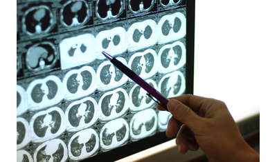 AIを用いた医用画像の多面的解釈
～肺がん検診画像の価値を拡大する新技術～