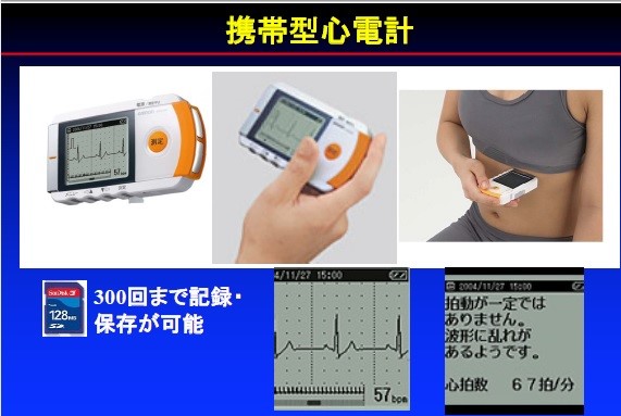 携帯型を用いることで自宅でも簡単に心電図を取ることができる（熊谷浩一郎医師提供）