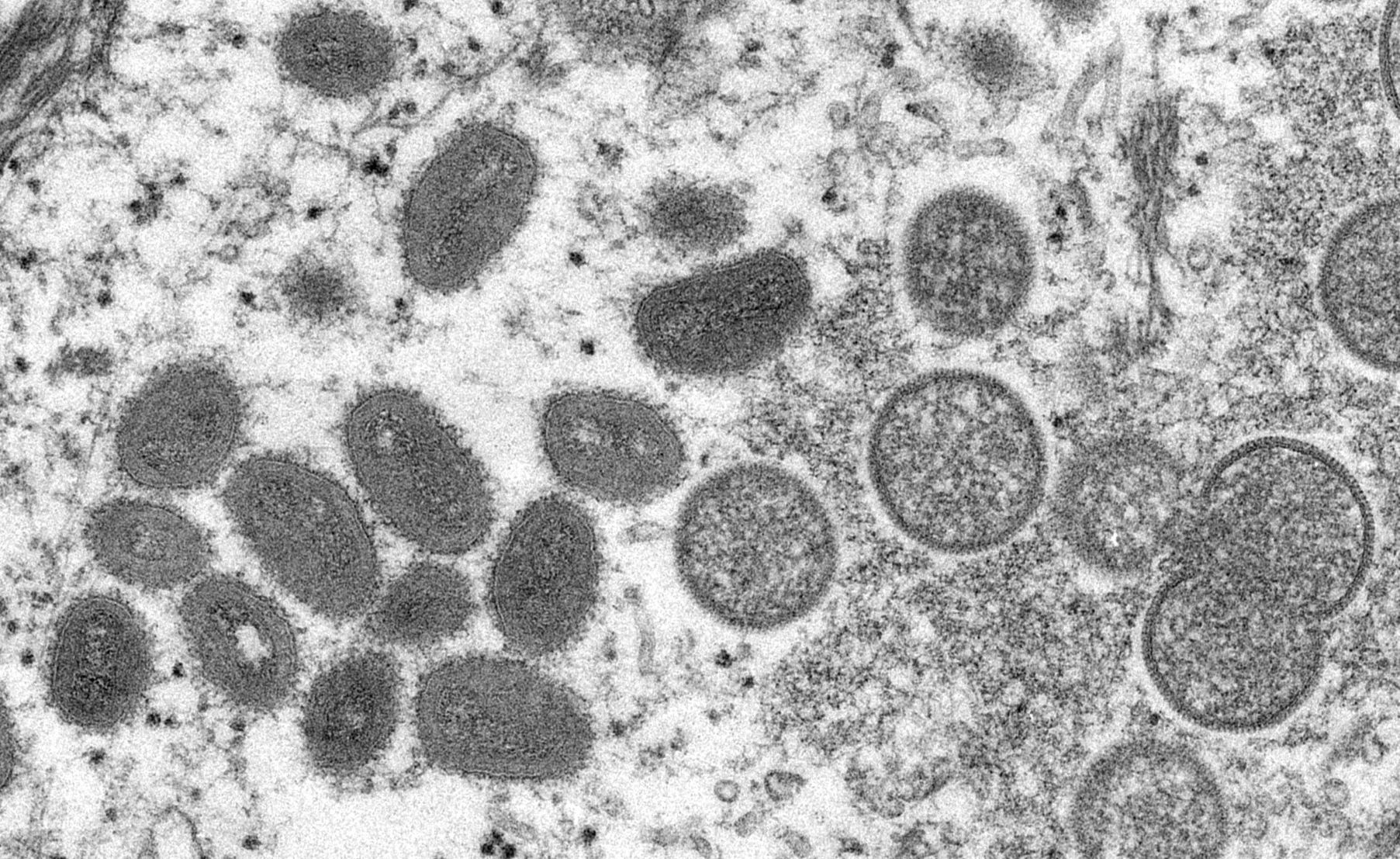 サル痘ウイルスの電子顕微鏡写真＝米疾病対策センター（ＣＤＣ）提供＝AFP時事