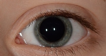 瞳孔が5mm以上でライトを当てても縮瞳しないことを確認する（画像はイメージです。大津秀一氏提供）