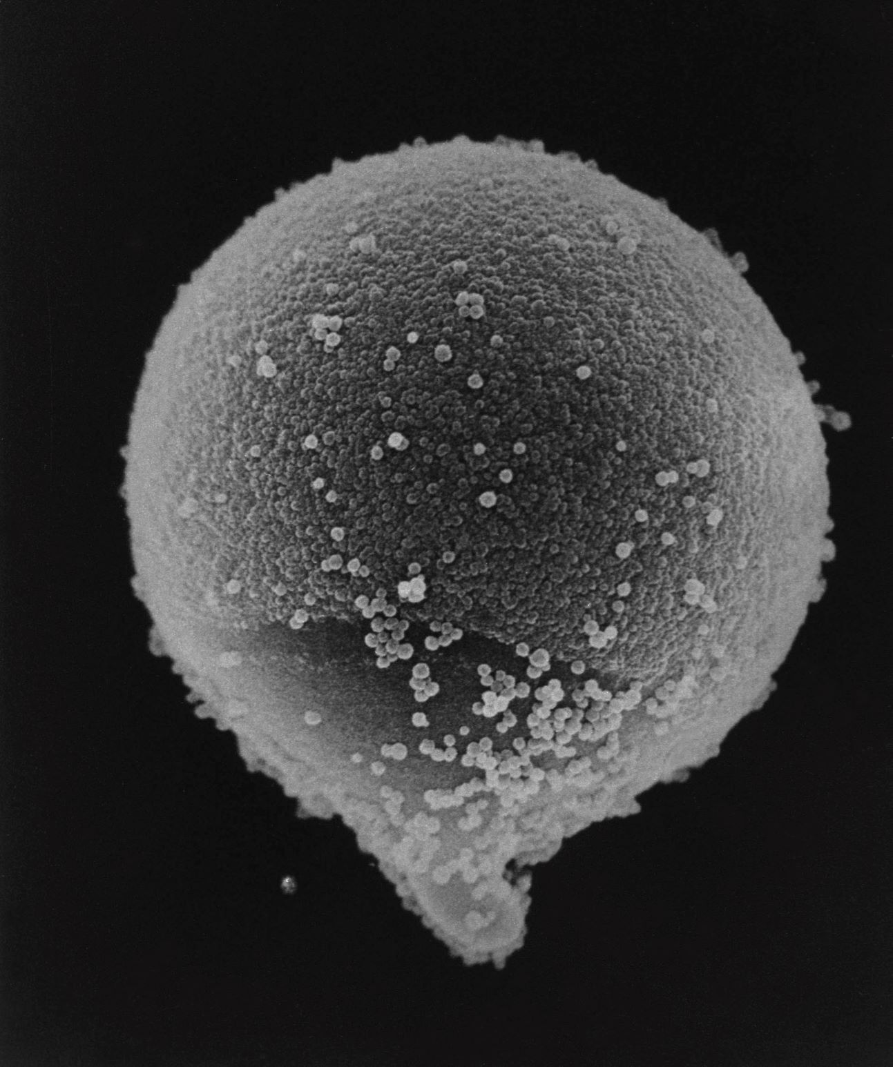 スギ花粉の顕微鏡写真。角のような突起があるのが特徴。直径は約３０ミクロン
