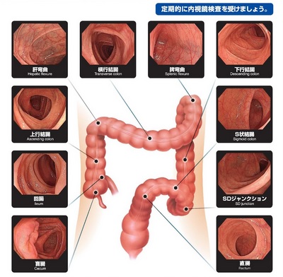 大腸内部の様子（オリンパス医療情報サイト「メディカルタウン」より）