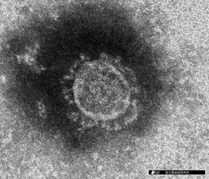 新型コロナウイルスの顕微鏡写真（国立感染症研究所ホームページより）
