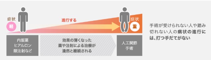 手術が受けられない人の病状の進行には打つ手立てがない(ひざ関節症クリニック作成)