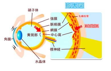 黄斑部とその拡大図