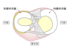 半月板の仕組み（ひざ関節症クリニック作成）