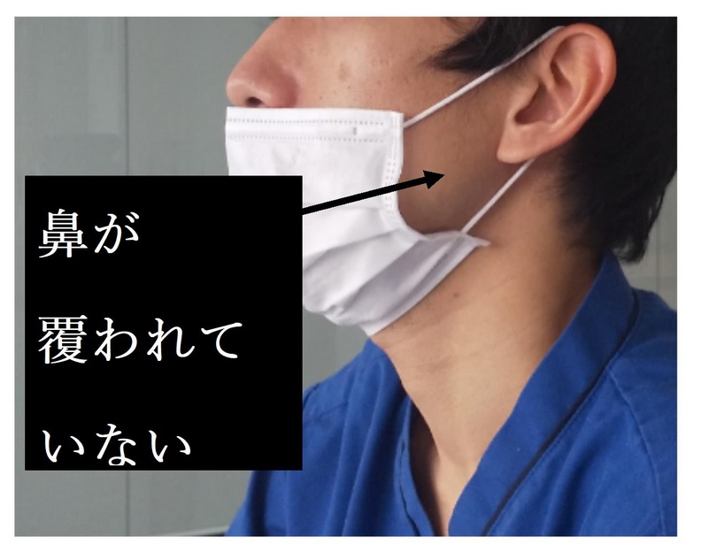 スタッフの教育に使われている間違ったマスクの装着例 （東京医科大学病院 感染制御部提供）