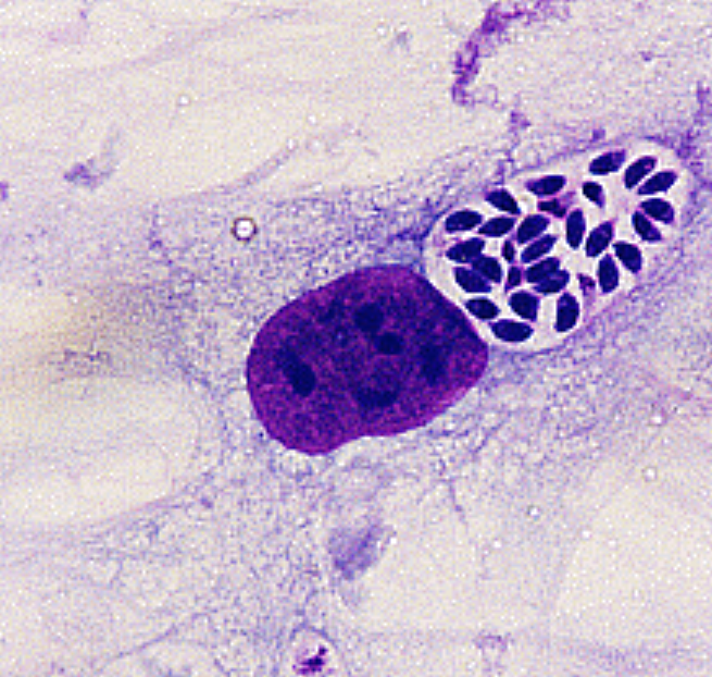 トキソプラズマ感染症を引き起こす原虫