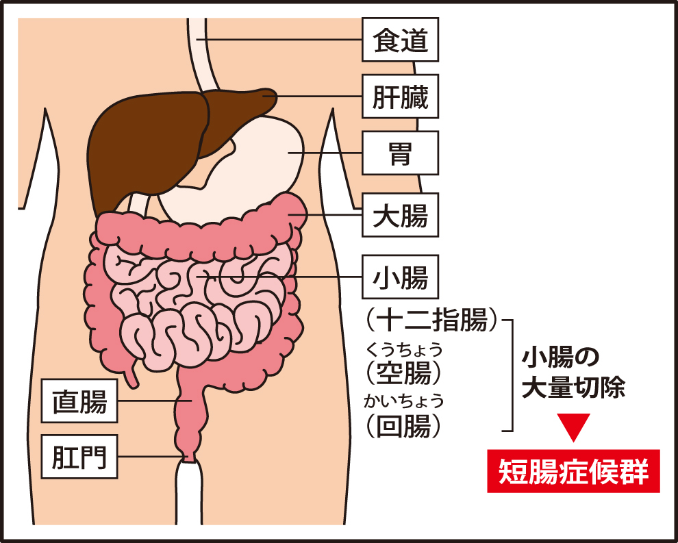 消化管の構造と短腸症候群