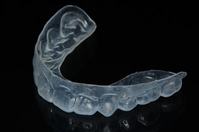 歯に装着するアライナー型矯正装置＝日本臨床矯正歯科医会提供