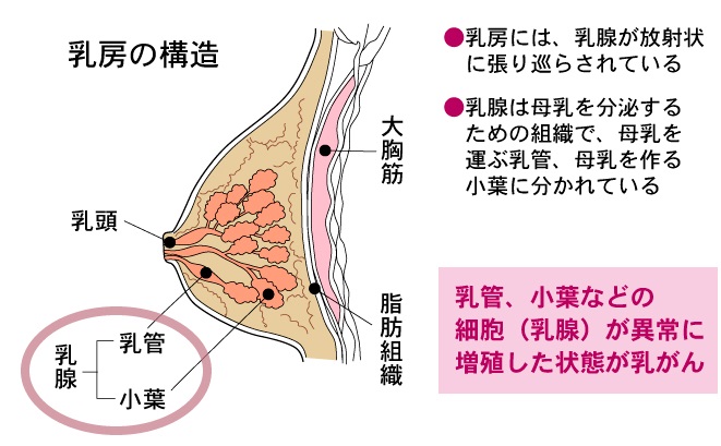 乳がんはどのような病気か＝NPO法人「キャンサーネットジャパン」資料を基に作成