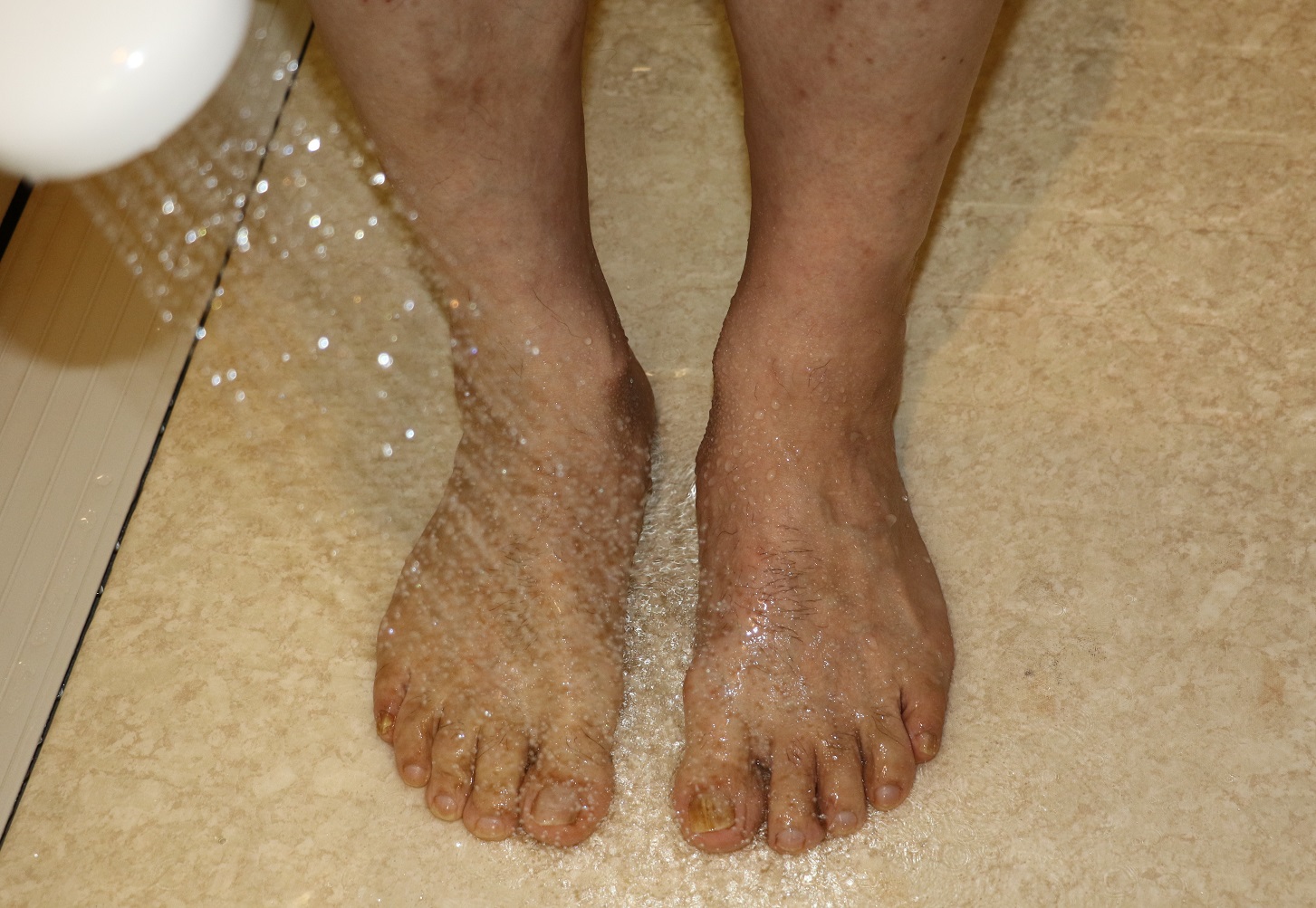 感染する前に足を洗って菌を落とす