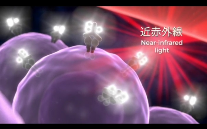 光免疫療法のイメージ図。紫色のがん細胞と結び付いた抗体薬に近赤外光を当てて破壊する＝米国立衛生研究所提供
