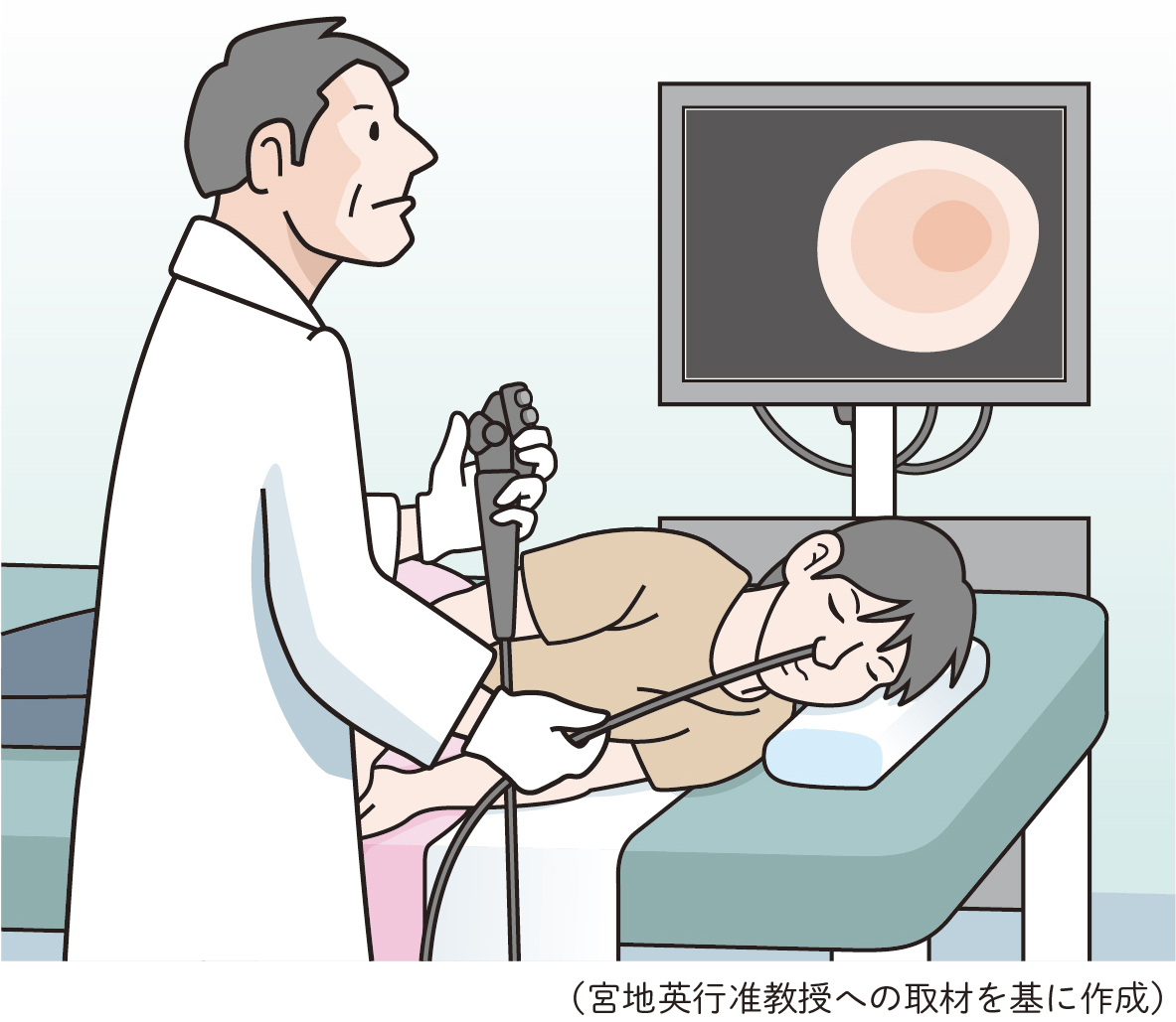 十二指腸潰瘍の診断には胃カメラなどを行う