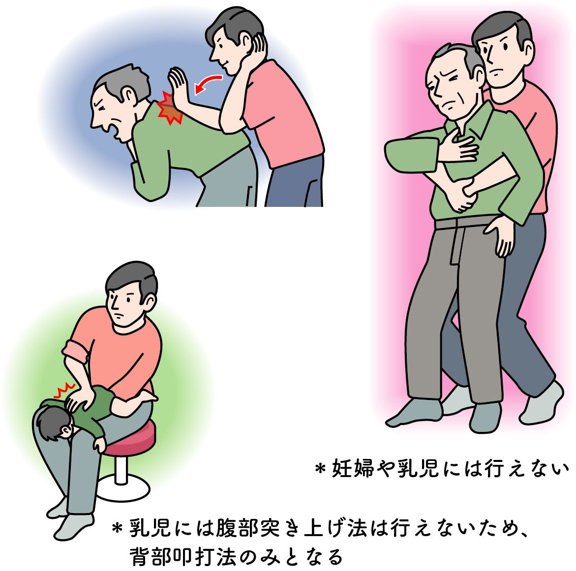 腹部突き上げ法（右）と背部叩打法（左２点）