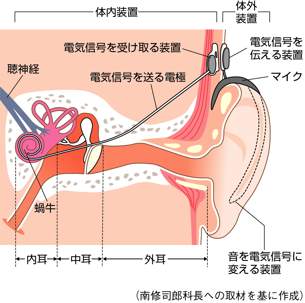 耳の構造と人工内耳の仕組み