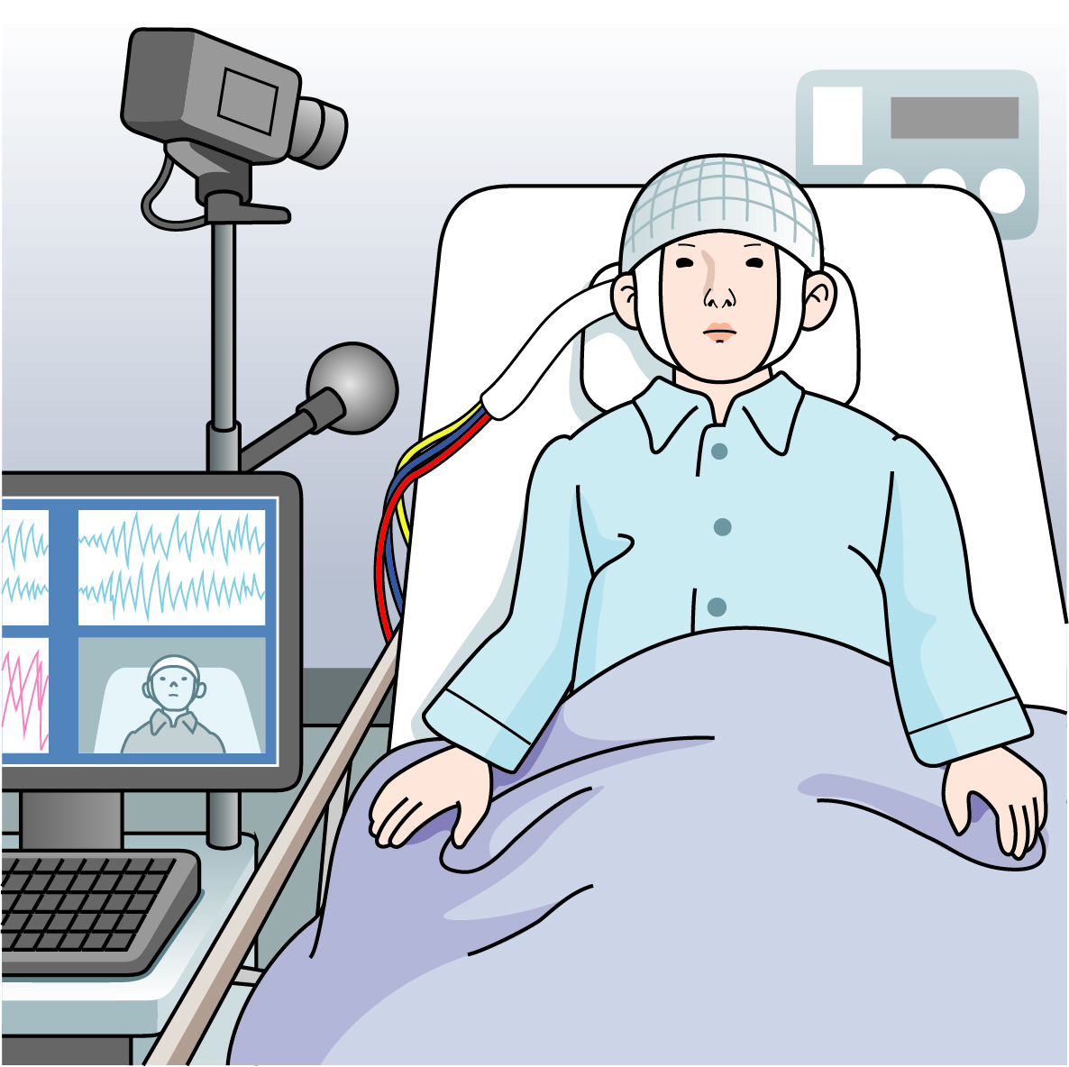 判断が難しいケースでは、長時間ビデオ脳波モニタリングで脳波を確認