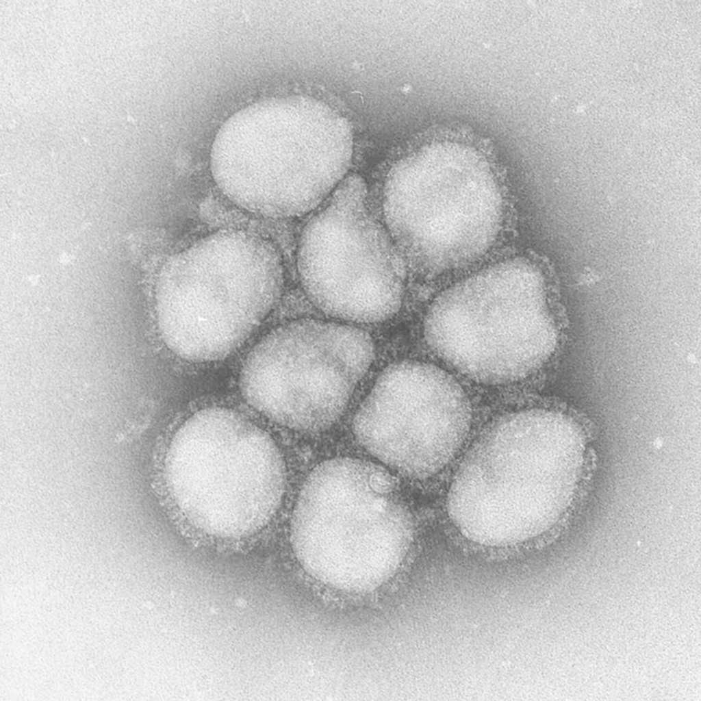 インフルエンザＡ型のウィルス＝国立感染症研究所提供