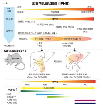 図1．胆管内乳頭状腫瘍(IPNB)の分類の変遷と本研究での マウスモデルの概略図