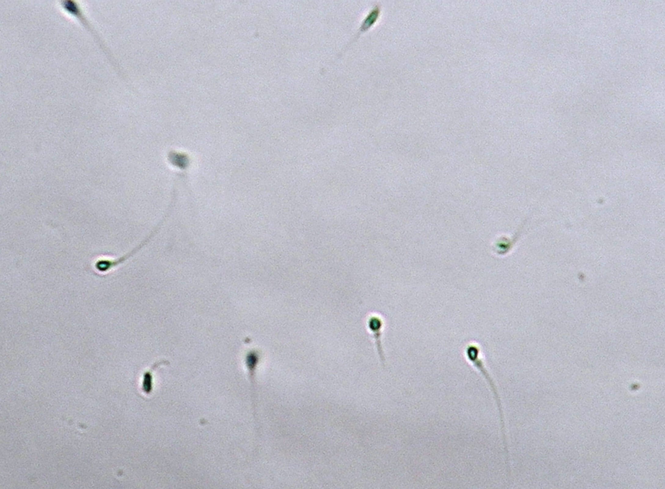 精子の質や動きが妊娠に関わる＝オーク銀座レディースクリニック提供