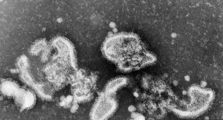 １９７７年１２月にソ連で流行したインフルエンザウイルス［国立予防衛生研究所提供］【時事】
