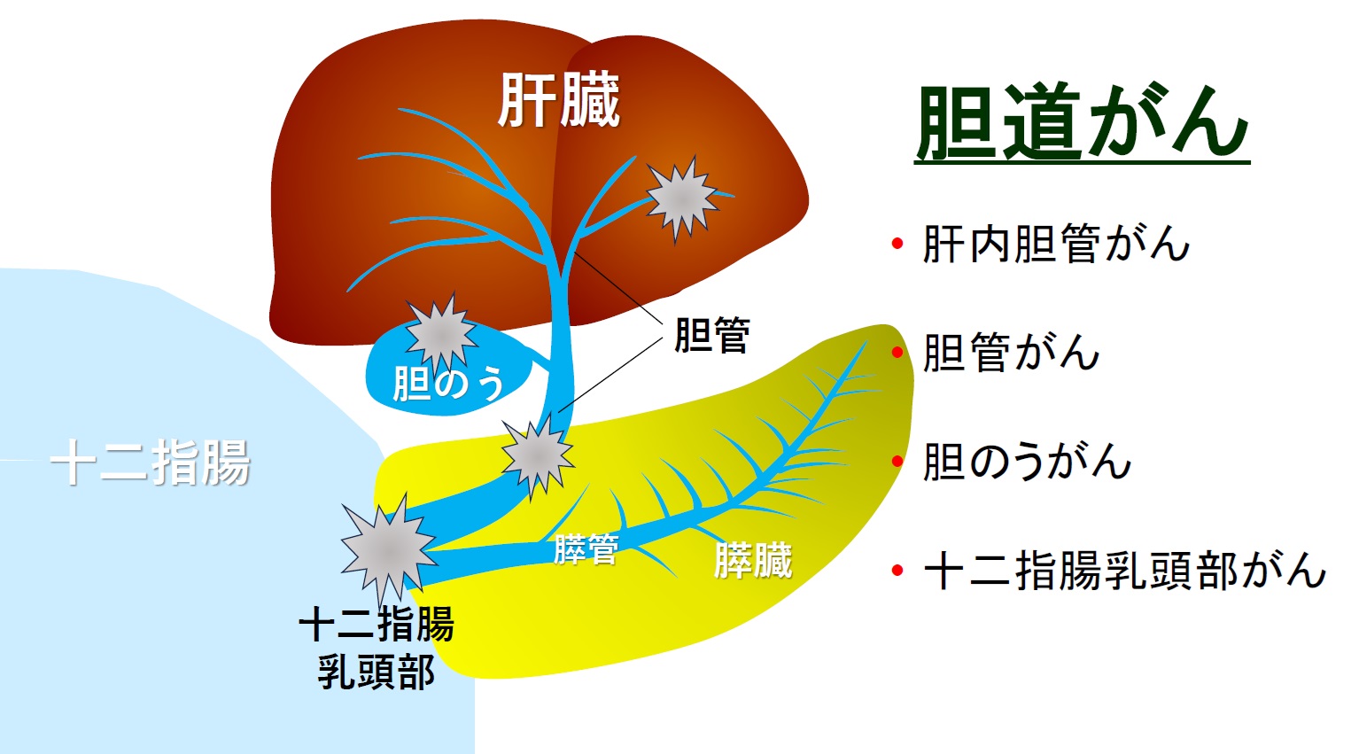 胆道がんができる場所＝アストラゼネカ胆道がんメディアセミナー資料より