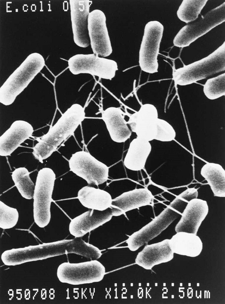 病原性大腸菌Ｏ（オー）１５７の電子顕微鏡写真＝東京都立衛生研究所提供