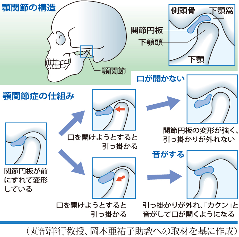 顎関節の構造と顎関節症