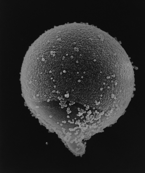 花粉症の原因になるスギ花粉の顕微鏡写真。角のような突起があるのが特徴。直径は約３０ミクロン