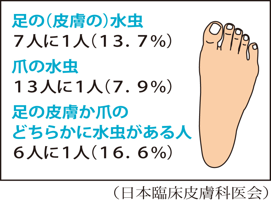 日本人の水虫・爪水虫の頻度