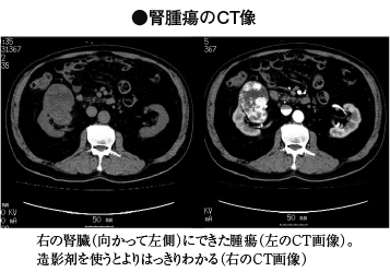 画像診断法 家庭の医学 時事メディカル 時事通信の医療ニュースサイト