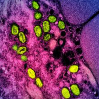 着色されたサル痘ウイルスの電子顕微鏡写真＝撮影日不明、米国立アレルギー・感染症研究所（ＮＩＡＩＤ）提供（ＡＦＰ時事）